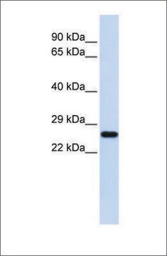 Anti-SOD2 antibody produced in rabbit affinity isolated antibody