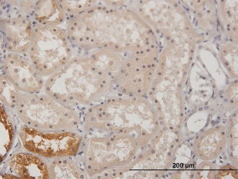 Anti-GK antibody produced in mouse IgG fraction of antiserum, buffered aqueous solution