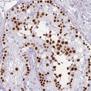 Anti-VCX2 antibody produced in rabbit Prestige Antibodies&#174; Powered by Atlas Antibodies, affinity isolated antibody, buffered aqueous glycerol solution