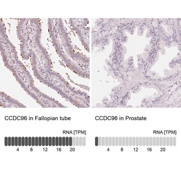 Anti-CCDC96 antibody produced in rabbit Prestige Antibodies&#174; Powered by Atlas Antibodies, affinity isolated antibody, buffered aqueous glycerol solution