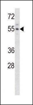 ANTI-MOUSE ACVR2A (N-TERM) antibody produced in rabbit IgG fraction of antiserum, buffered aqueous solution