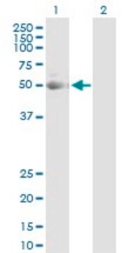 Anti-KRT7 antibody produced in rabbit purified immunoglobulin, buffered aqueous solution