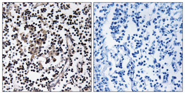 Anti-SLC30A4 antibody produced in rabbit affinity isolated antibody