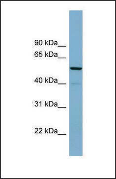 Anti-CDK5RAP1, (N-terminal) antibody produced in rabbit affinity isolated antibody