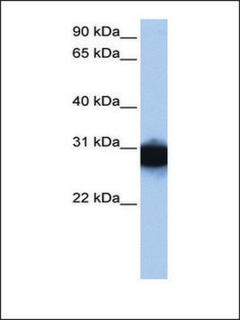 Anti-TPI1 antibody produced in rabbit affinity isolated antibody