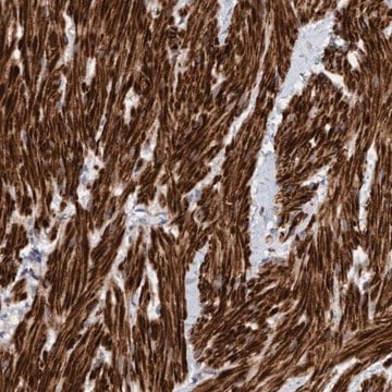 Anti-LONRF1 antibody produced in rabbit Prestige Antibodies&#174; Powered by Atlas Antibodies, affinity isolated antibody, buffered aqueous glycerol solution, Ab1