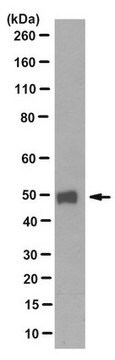 Anti-PIP4K2B (PIP5K2B) Antibody, clone 7D10.1 clone 7D10.1, from mouse