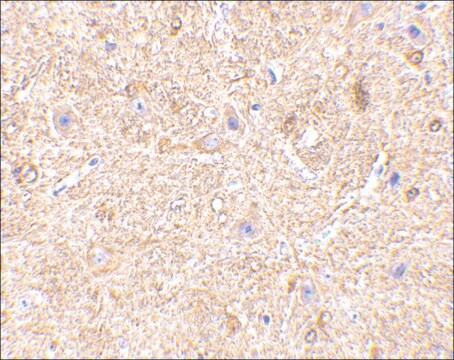 Anti-VISA (ab2) antibody produced in rabbit affinity isolated antibody, buffered aqueous solution