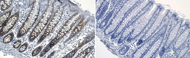 Anti-FAM72 Antibody, clone 1K2 ZooMAb&#174; Rabbit Monoclonal recombinant, expressed in HEK 293 cells