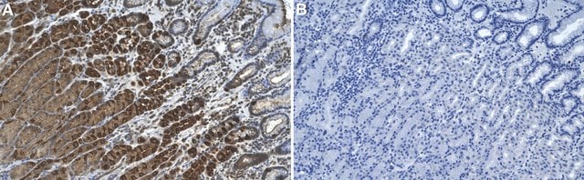 Anti-Rab11 Antibody, clone 1C16 ZooMAb&#174; Rabbit Monoclonal recombinant, expressed in HEK 293 cells