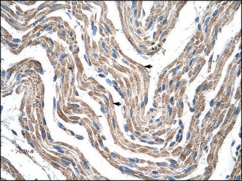 Anti-PDK4 antibody produced in rabbit affinity isolated antibody