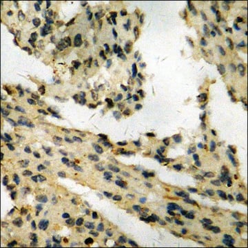 Anti-phospho-Retinoblastoma (pSer795) antibody produced in rabbit affinity isolated antibody