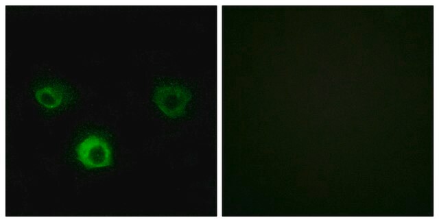 Anti-CCR4 antibody produced in rabbit affinity isolated antibody