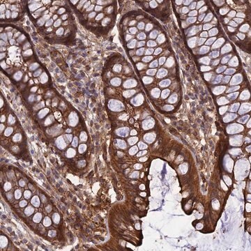 Anti-CRTAP antibody produced in rabbit Prestige Antibodies&#174; Powered by Atlas Antibodies, affinity isolated antibody, buffered aqueous glycerol solution