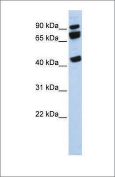 Anti-DDX17 antibody produced in rabbit affinity isolated antibody