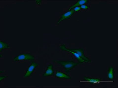 Anti-RIOK2 antibody produced in rabbit purified immunoglobulin, buffered aqueous solution