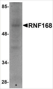 Anti-RNF168 antibody produced in rabbit affinity isolated antibody, buffered aqueous solution