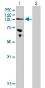 抗HK3抗体 ウサギ宿主抗体 purified immunoglobulin, buffered aqueous solution