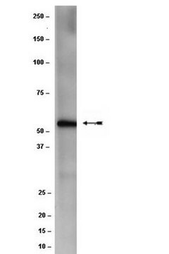 Anti-CCT-beta Antibody, clone F39 P7 F11 clone F39 P7 F11, Chemicon&#174;, from mouse