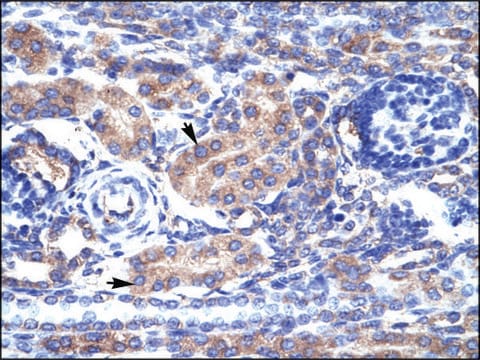 Anti-KCNAB3 antibody produced in rabbit IgG fraction of antiserum