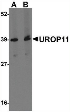 Anti-UROP11 antibody produced in rabbit affinity isolated antibody, buffered aqueous solution