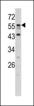 ANTI-DONSON (N-TERM) antibody produced in rabbit IgG fraction of antiserum, buffered aqueous solution