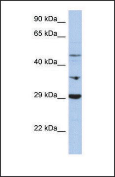 Anti-PDK3 antibody produced in rabbit affinity isolated antibody