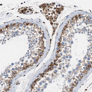 Anti-HSD17B12 antibody produced in rabbit Prestige Antibodies&#174; Powered by Atlas Antibodies, affinity isolated antibody, buffered aqueous glycerol solution