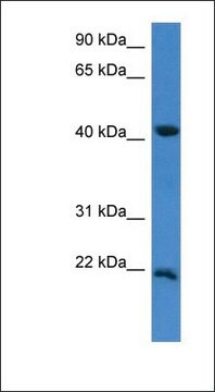 Anti-IMMP2L antibody produced in rabbit affinity isolated antibody