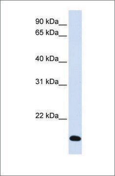 Anti-RNF185 antibody produced in rabbit affinity isolated antibody