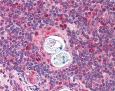 Anti-AIRE (Isoforms 1 and 2) (AB2) antibody produced in goat affinity isolated antibody, buffered aqueous solution