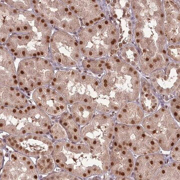 Anti-CEP83 antibody produced in rabbit Prestige Antibodies&#174; Powered by Atlas Antibodies, affinity isolated antibody, buffered aqueous glycerol solution