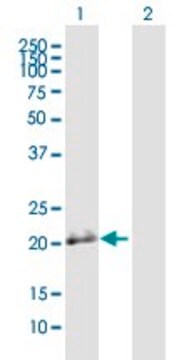 Anti-BSPRY antibody produced in mouse IgG fraction of antiserum, buffered aqueous solution