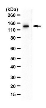 Anti-DBC1 Antibody from rabbit