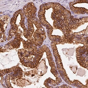 Anti-IQGAP2 antibody produced in rabbit Prestige Antibodies&#174; Powered by Atlas Antibodies, affinity isolated antibody, buffered aqueous glycerol solution