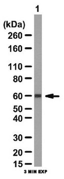 Anti-YAP1 Antibody from rabbit, purified by affinity chromatography