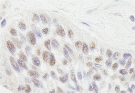 Rabbit anti-RIF1 Antibody, Affinity Purified Powered by Bethyl Laboratories, Inc.