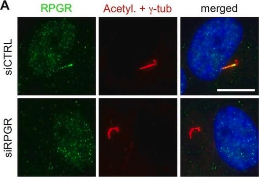 抗-RPGR 兔抗 Prestige Antibodies&#174; Powered by Atlas Antibodies, affinity isolated antibody, buffered aqueous glycerol solution