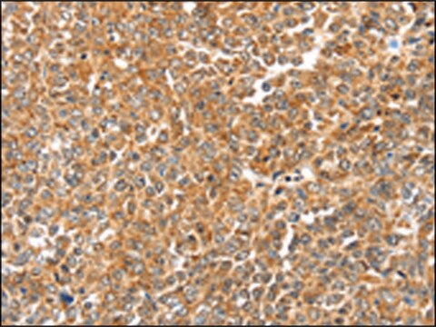 Anti-LOXL2 affinity isolated antibody