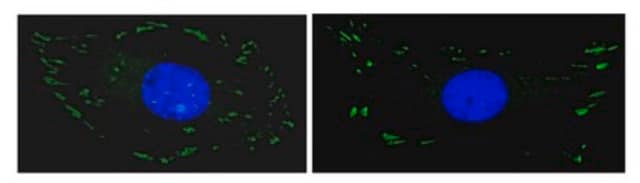 Anti-FAK Antibody, clone 4.47, Alexa Fluor&#8482; 488 conjugate clone 4.47, Upstate&#174;, from mouse