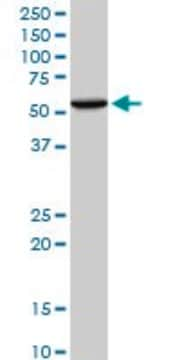 Anti-WARS antibody produced in mouse purified immunoglobulin, buffered aqueous solution