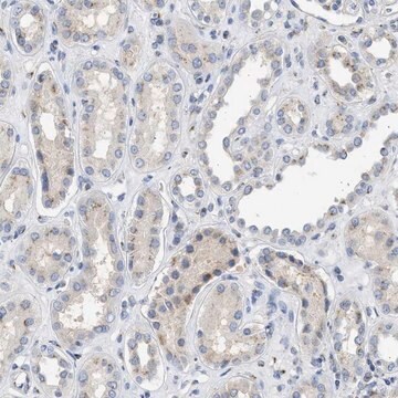 Anti-IPO8 antibody produced in rabbit Prestige Antibodies&#174; Powered by Atlas Antibodies, affinity isolated antibody, buffered aqueous glycerol solution