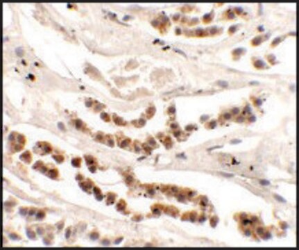 Anti-DISP1 antibody produced in rabbit affinity isolated antibody