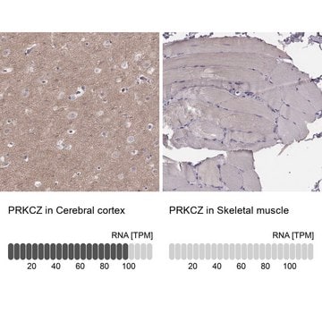 Anti-PRKCZ antibody produced in rabbit Prestige Antibodies&#174; Powered by Atlas Antibodies, affinity isolated antibody, buffered aqueous glycerol solution