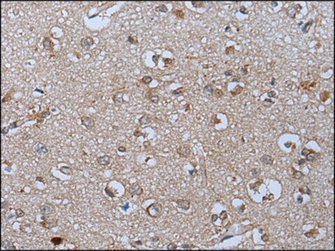 Anti-PYM1 affinity isolated antibody