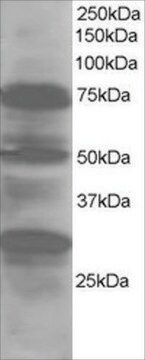 Anti-LMO7/FBXO20 antibody produced in goat affinity isolated antibody, buffered aqueous solution