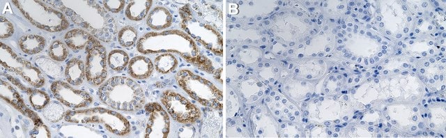 Anti-Mitofusin-1 Antibody, clone 1I7 ZooMAb&#174; Rabbit Monoclonal recombinant, expressed in HEK 293 cells