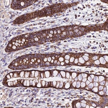 Anti-OCIAD1 antibody produced in rabbit Prestige Antibodies&#174; Powered by Atlas Antibodies, affinity isolated antibody, buffered aqueous glycerol solution