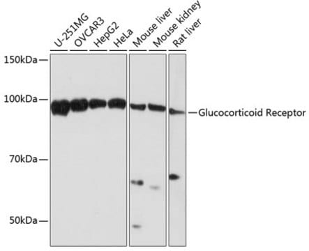 Anti-Glucocorticoid Receptor Antibody, clone 2K3E8, Rabbit Monoclonal