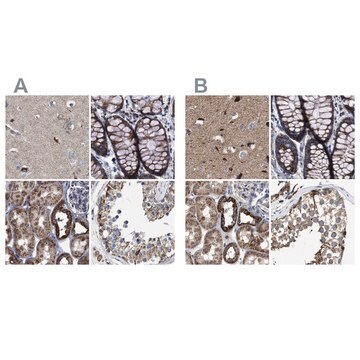 Anti-MECR antibody produced in rabbit Prestige Antibodies&#174; Powered by Atlas Antibodies, affinity isolated antibody, buffered aqueous glycerol solution, Ab2